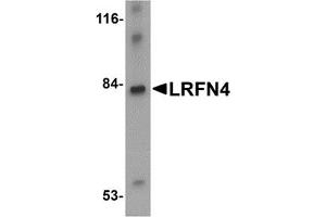 Western Blotting (WB) image for anti-Leucine Rich Repeat and Fibronectin Type III Domain Containing 4 (LRFN4) (C-Term) antibody (ABIN1030491)