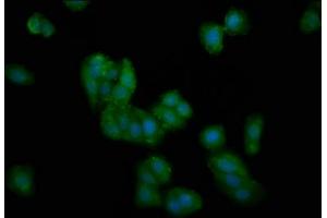 Immunofluorescence staining of HepG2 cells with ABIN7149966 at 1:100, counter-stained with DAPI. (DMGDH 抗体  (AA 429-524))