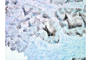 Immunohistochemistry analysis using Mouse Anti-Hsp60 Monoclonal Antibody, Clone LK-2 (ABIN361786 and ABIN361787). (HSPD1 抗体)