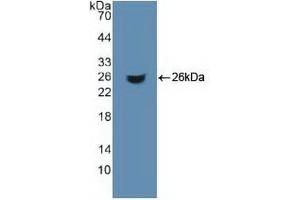 WB of Protein Standard: different control antibodies against Highly purified E.