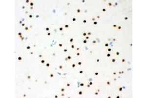 IHC-P testing of rat brain tissue (MSK1 抗体  (AA 540-665))