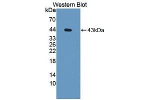 Western blot analysis of recombinant Rat CCK. (Cholecystokinin 抗体  (AA 1-115))