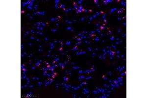 Immunofluorescence of paraffin embedded mouse lung using LTF (ABIN7074457) at dilution of 1: 700 (250x lens) (Lactoferrin 抗体)