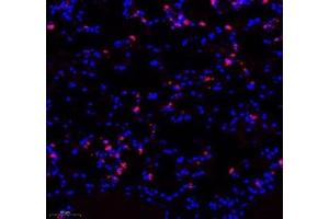Immunofluorescence of paraffin embedded mouse lung using LTF (ABIN7074457) at dilution of 1: 700 (250x lens)