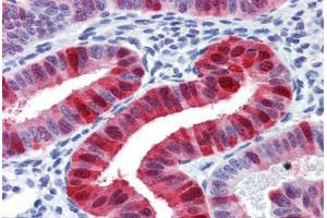 Uterus, Human: Formalin-Fixed, Paraffin-Embedded (FFPE) (Metallothionein 抗体)