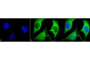 Immunocytochemistry/Immunofluorescence analysis using Mouse Anti-Ubiquitin Monoclonal Antibody, Clone 5B9-B3 (ABIN361810 and ABIN361811). (Ubiquitin 抗体)