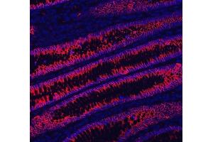 IF analysis of LI Cadherin/CDH17 using anti-LI Cadherin/CDH17 antibody (ABIN7600855). (LI Cadherin 抗体  (AA 24-695))