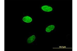 Immunofluorescence of purified MaxPab antibody to LBR on HeLa cell. (Lamin B Receptor 抗体  (AA 1-615))