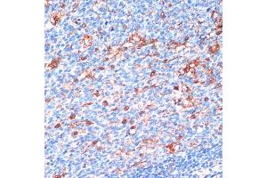 Immunohistochemistry (IHC) image for anti-14-3-3 alpha + beta (YWHAB) (AA 1-246) antibody (ABIN3021285)
