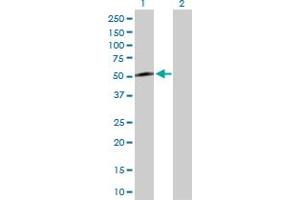 Western Blot analysis of KLF8 expression in transfected 293T cell line by KLF8 MaxPab polyclonal antibody. (KLF8 抗体  (AA 1-359))