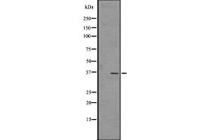 Western Blotting (WB) image for anti-Olfactory Receptor, Family 4, Subfamily C, Member 45 (OR4C45) antibody (ABIN6259521)