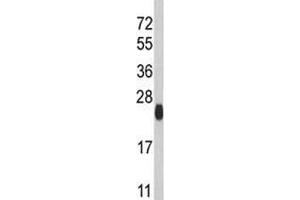 Western blot analysis of ATG12 antibody and mouse brain tissue lysate (ATG12 抗体  (AA 1-50))