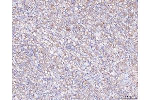 IHC analysis of ATX2/ATXN2 using anti-ATX2/ATXN2 antibody (ABIN3043507). (Ataxin 2 抗体  (C-Term))