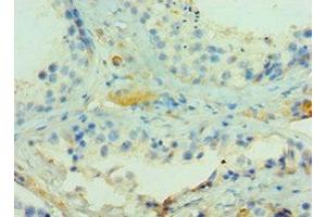 Immunohistochemistry of paraffin-embedded human testis tissue using ABIN7143270 at dilution of 1:100 (ADAMTSL1 抗体  (AA 1483-1762))