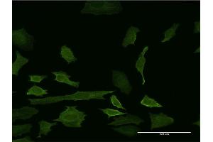 Immunofluorescence of monoclonal antibody to IDO1 on HeLa cell. (IDO1 抗体  (AA 304-403))