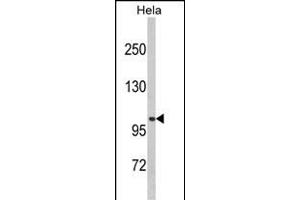 Western blot analysis of CASK (Center ) (ABIN6243846 and ABIN6578982) in Hela cell line lysates (35 μg/lane). (CASK 抗体  (AA 262-291))