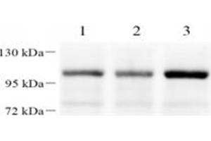 Western blot analysis of FOXK1 (ABIN7073970) at dilution of 1: 1000,Lane 1: HeLa cell lysate,Lane 2: 293T cell lysate,Lane 3: H1299 cell lysate (Foxk1 抗体)