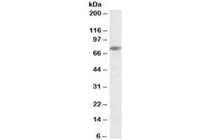 Western blot testing of Jurkat lysate with SLP76 antibody at 0. (LCP2 抗体)