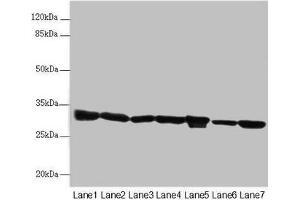 Western blot All lanes: ECHS1 antibody at 3. (ECHS1 抗体  (AA 28-290))