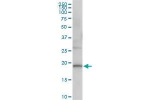 Immunoprecipitation of DUSP22 transfected lysate using anti-DUSP22 MaxPab rabbit polyclonal antibody and Protein A Magnetic Bead , and immunoblotted with DUSP22 purified MaxPab mouse polyclonal antibody (B01P) . (DUSP22 抗体  (AA 1-184))