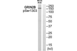 Western blot analysis of extracts from Mouse brain cells using GRIN2B (Phospho-Ser1303) Antibody. (GRIN2B 抗体  (pSer1303))