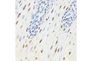 Immunohistochemistry of paraffin-embedded human esophageal using SLBP Rabbit pAb (ABIN7270590) at dilution of 1:100 (40x lens). (SLBP 抗体)