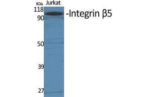 Western Blot (WB) analysis of specific cells using Integrin beta5 Polyclonal Antibody. (Integrin beta 5 抗体  (C-Term))