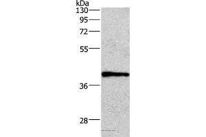 Western blot analysis of A549 cell, using WNT3A Polyclonal Antibody at dilution of 1:400 (WNT3A 抗体)