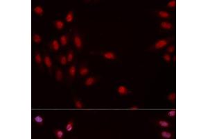Immunofluorescence analysis of MCF-7 cells using Phospho-CHEK1(S317) Polyclonal Antibody (CHEK1 抗体  (pSer317))