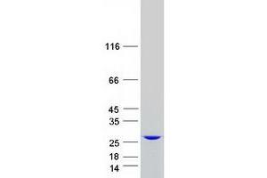 Western Blotting (WB) image for Heme Binding Protein 1 (HEBP1) protein (Myc-DYKDDDDK Tag) (ABIN2722599)