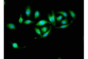 Immunofluorescence staining of A549 cells with ABIN7142296 at 1:133, counter-stained with DAPI. (HSD17B1 抗体  (AA 2-261))
