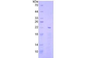 SDS-PAGE analysis of Human EGR1 Protein. (EGR1 蛋白)