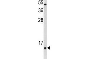 Western blot analysis of SOD1 antibody and Jurkat lysate. (SOD1 抗体  (AA 55-84))