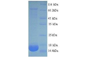 SDS-PAGE (SDS) image for Phospholipase A2, Group IIA (Platelets, Synovial Fluid) (PLA2G2A) (AA 22-146), (full length) protein (His tag) (ABIN7479447)
