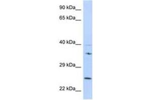Image no. 1 for anti-Growth Factor Receptor-Bound Protein 2 (GRB2) (N-Term) antibody (ABIN6747987)