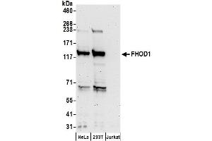 anti-Formin Homology 2 Domain Containing 1 (FHOD1) (AA 1050-1100) antibody