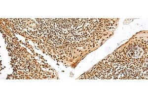 Immunohistochemistry of paraffin-embedded Human tonsil tissue using GRSF1 Polyclonal Antibody at dilution of 1:30(x200) (GRSF1 抗体)