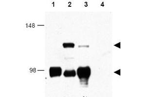 Image no. 1 for anti-CREB Regulated Transcription Coactivator 1 (CRTC1) (AA 19-34) antibody (ABIN401346) (CRTC1 抗体  (AA 19-34))