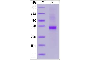 SDS-PAGE (SDS) image for SLAM Family Member 8 (SLAMF8) (AA 23-233) (Active) protein (His tag,AVI tag,Biotin) (ABIN6972956)