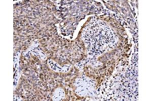 IHC analysis of MAFF using anti-MAFF antibody (ABIN7599317).
