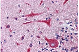 Immunohistochemistry (IHC) image for anti-Potassium Voltage-Gated Channel, Subfamily H (Eag-Related), Member 2 (KCNH2) (Internal Region) antibody (ABIN1048984)