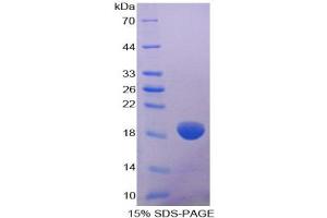 SDS-PAGE (SDS) image for Collagen, Type VIII, alpha 2 (COL8A2) protein (ABIN3008898)