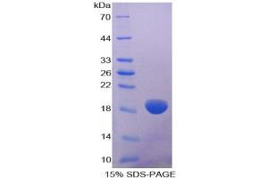 SDS-PAGE analysis of Human COL8A2 Protein. (COL8a2 蛋白)