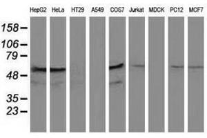 Image no. 1 for anti-Katanin P60 Subunit A-Like 1 (KATNAL1) antibody (ABIN1498985) (KATNAL1 抗体)