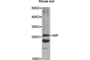 Western blot analysis of extracts of mouse eye, using MIP antibody (ABIN5971491) at 1:400 dilution. (MIP 抗体)