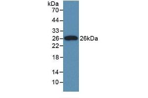 Detection of Recombinant CLU, Rat using Monoclonal Antibody to Clusterin (CLU) (Clusterin 抗体  (AA 227-447))