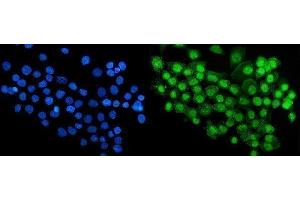IF analysis of RBM47 using anti-RBM47 antibody (ABIN7602242). (RBM47 抗体  (AA 66-317))