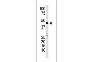 The anti-GDF3 N-term Pab (ABIN388818 and ABIN2839136) is used in Western blot to detect GDF3 in mouse kidney tissue lysate. (GDF3 抗体  (N-Term))