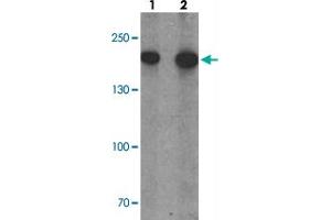 Western blot analysis of PHLPP1 in SW480 cell lysate with PHLPP1 polyclonal antibody  at (1) 1 and (2) 2 ug/mL. (PHLPP1 抗体  (N-Term))