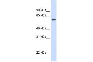 Catalase antibody used at 1 ug/ml to detect target protein. (Catalase 抗体  (Middle Region))